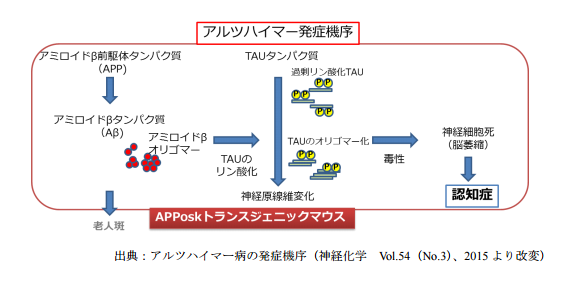 アルツハイマー