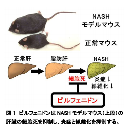 肝炎