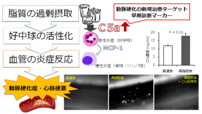 動脈硬化