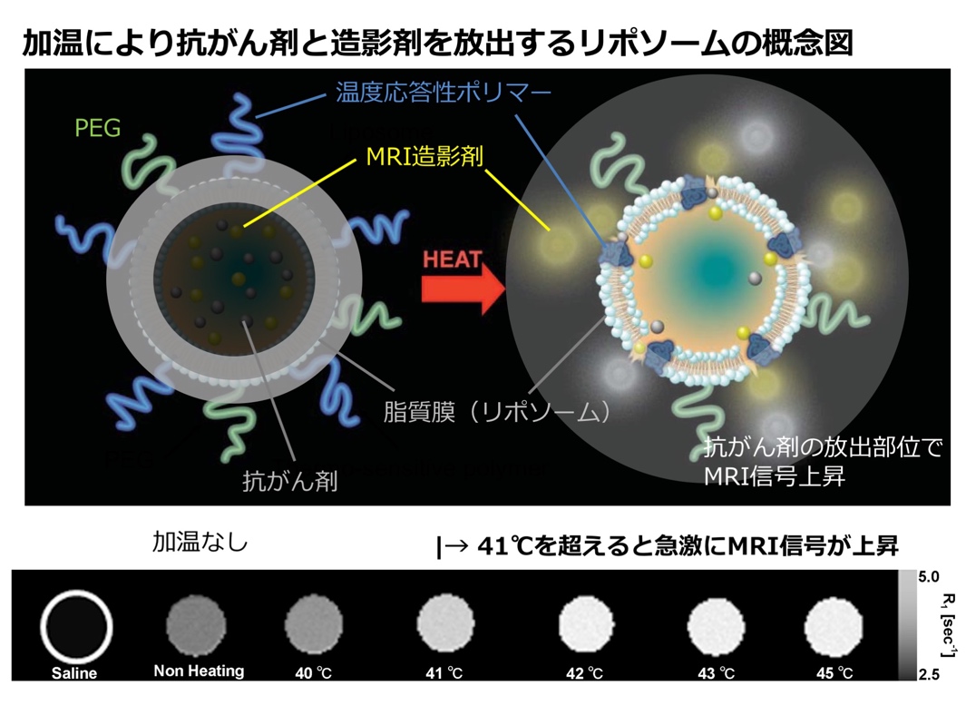 ナノ薬剤送達治療システム