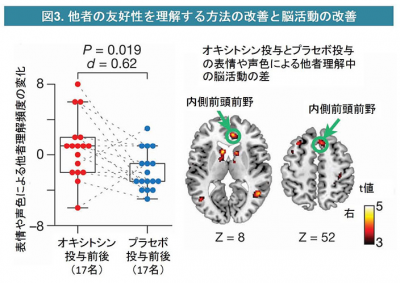 自閉スペクトラム症