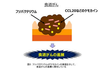 食堂がん