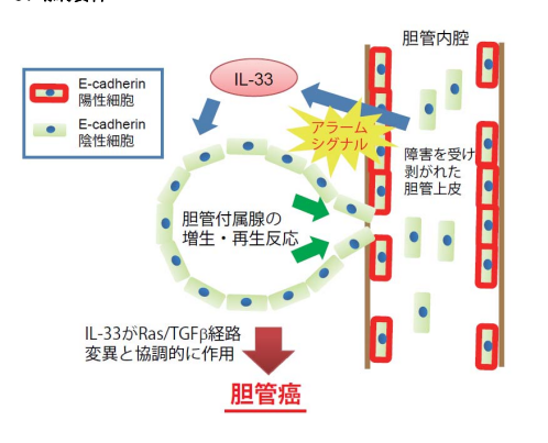 胆管癌