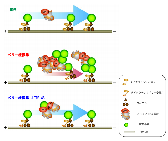 ペリー症候群