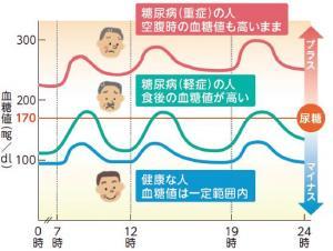 尿糖検査