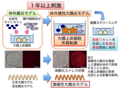 潰瘍性大腸炎