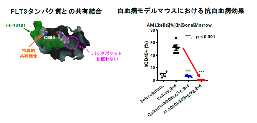 急性骨髄性白血病