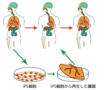 iPS細胞