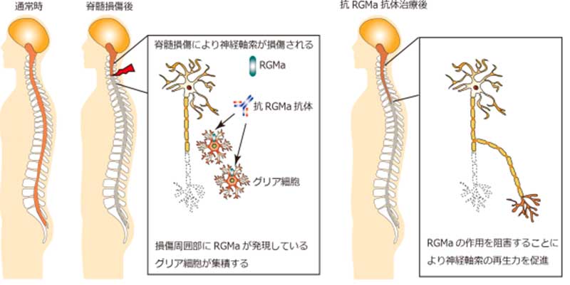 抗体治療