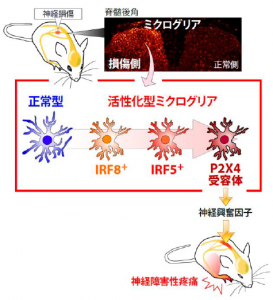 神経障害性疼痛
