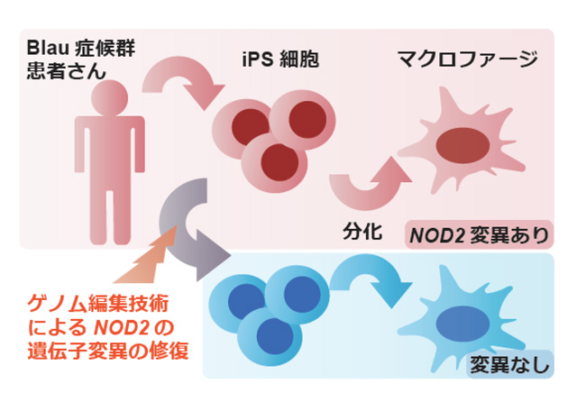 Blau症候群