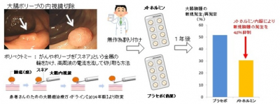 大腸がん