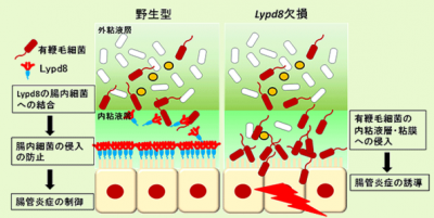 潰瘍性大腸炎
