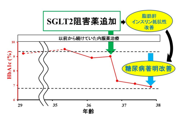 糖尿病