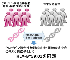 統合失調症