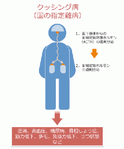 クッシング病