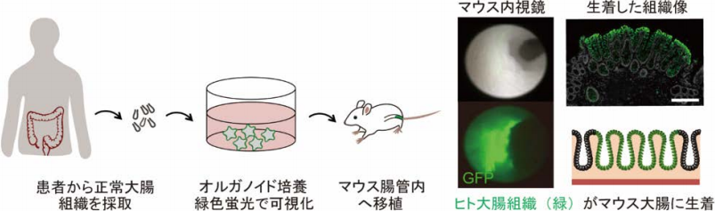 ヒトの正常大腸上皮