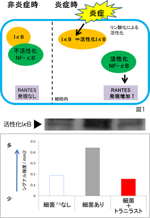 トラニラスト