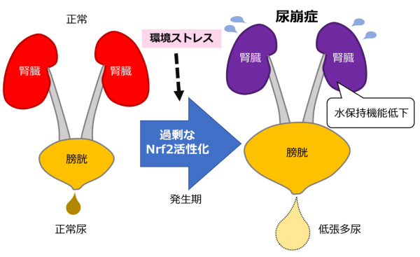 腎性尿崩症