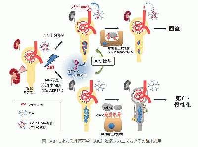 急性腎不全