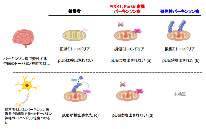 パーキンソン病