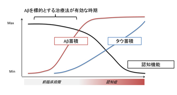 アルツハイマー病