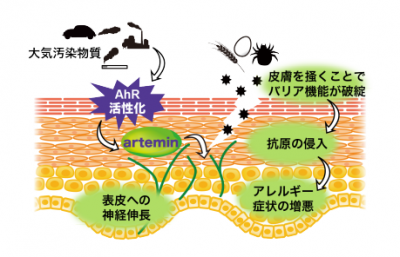 アトピー性皮膚炎